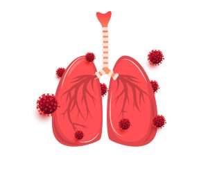 Flat design coronavirus pneumonia and lung infection by the virus. Disease, cancer and treatment concept. Coronavirus pneumonia and lung infection by the virus isolated on white background. Disease, cancer and treatment concept.