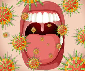 Herpes simplex virus (Lips/Mouth) Herpes simplex virus (Lips/Mouth) illustration